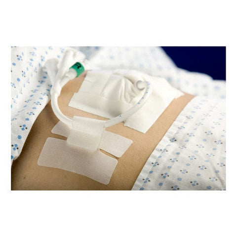 M.C. Johnson, Cath-Secure, 1 Each M.C. Johnson